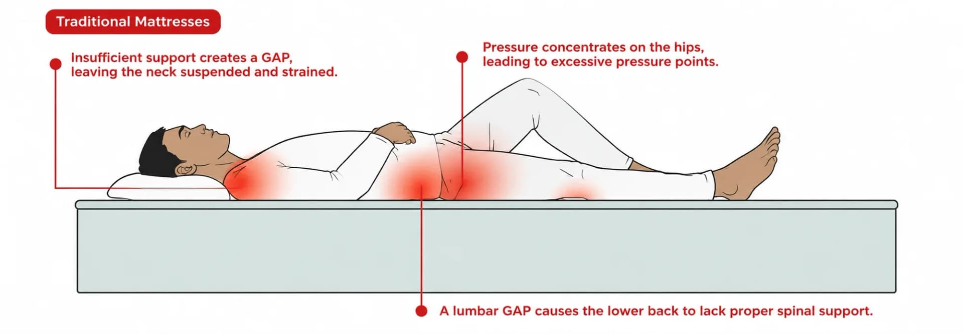 Diagram of a person on their back on a traditional mattress: support gaps at the neck and lower back, pressure concentrated on the hips