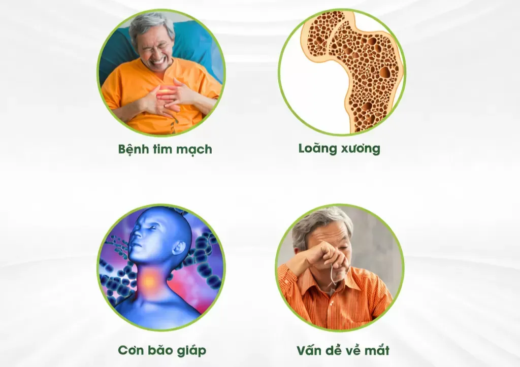 Bệnh cường giáp có nguy hiểm không? Các biến chứng tiềm ẩn
