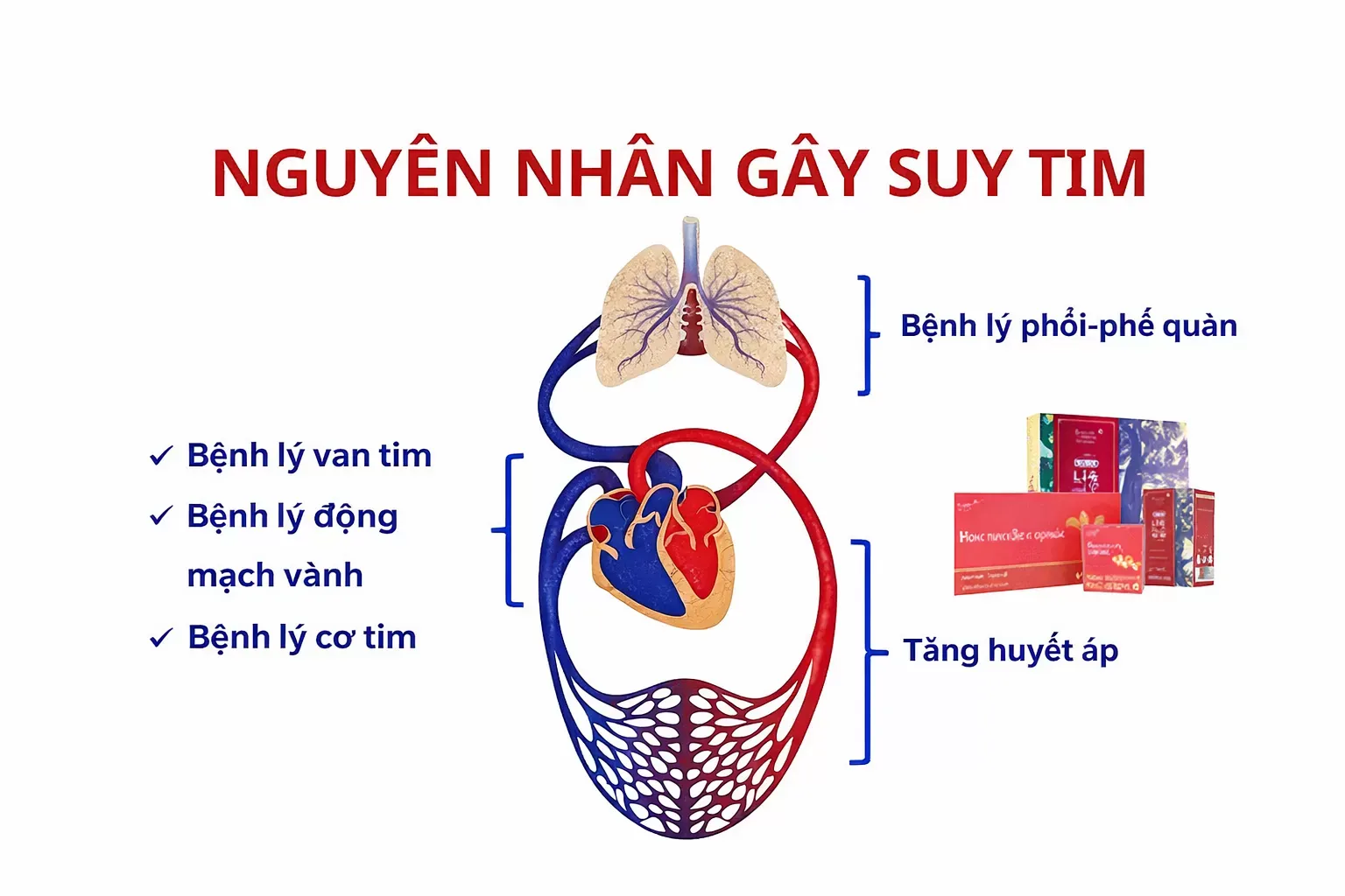 Nguyên nhân gây bệnh suy tim