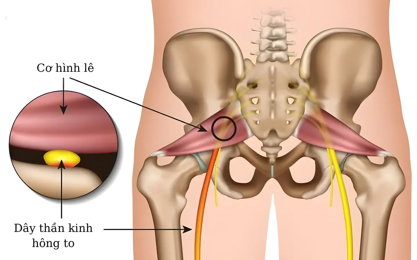 Giải phẫu cơ hình lê và dây thần kinh tọa