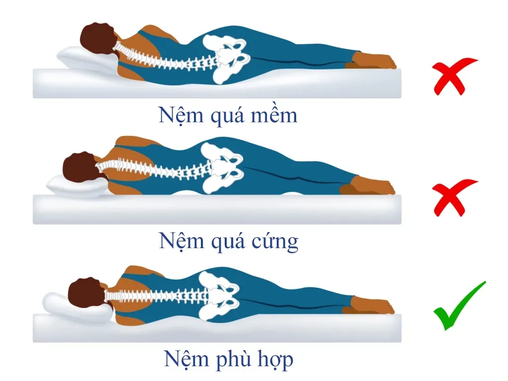 Minh họa tư thế cột sống khi nằm trên nệm quá mềm, nệm quá cứng và nệm phù hợp