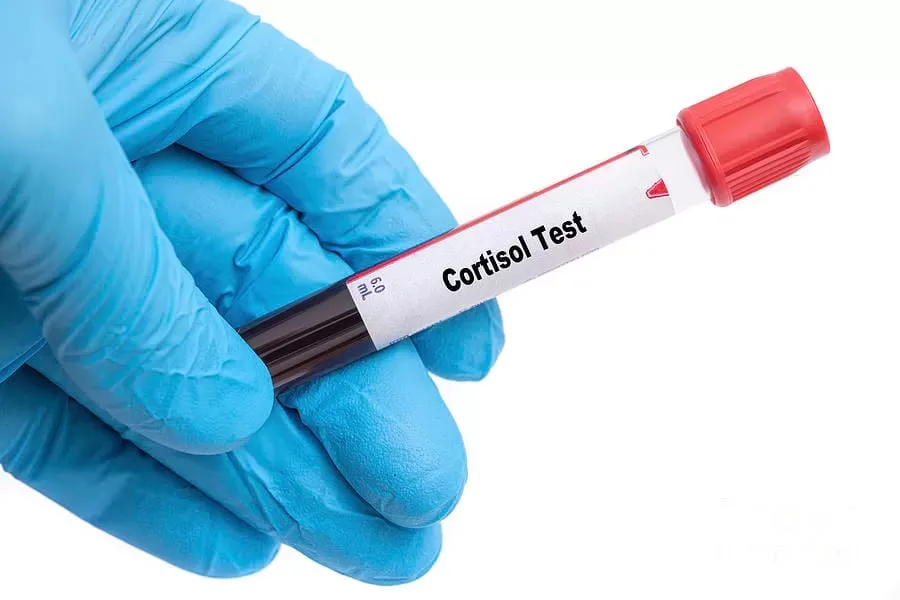 Bác sĩ sẽ chỉ định xét nghiệm cortisol nếu người bệnh có các biểu hiện của rối loạn hệ thống nội