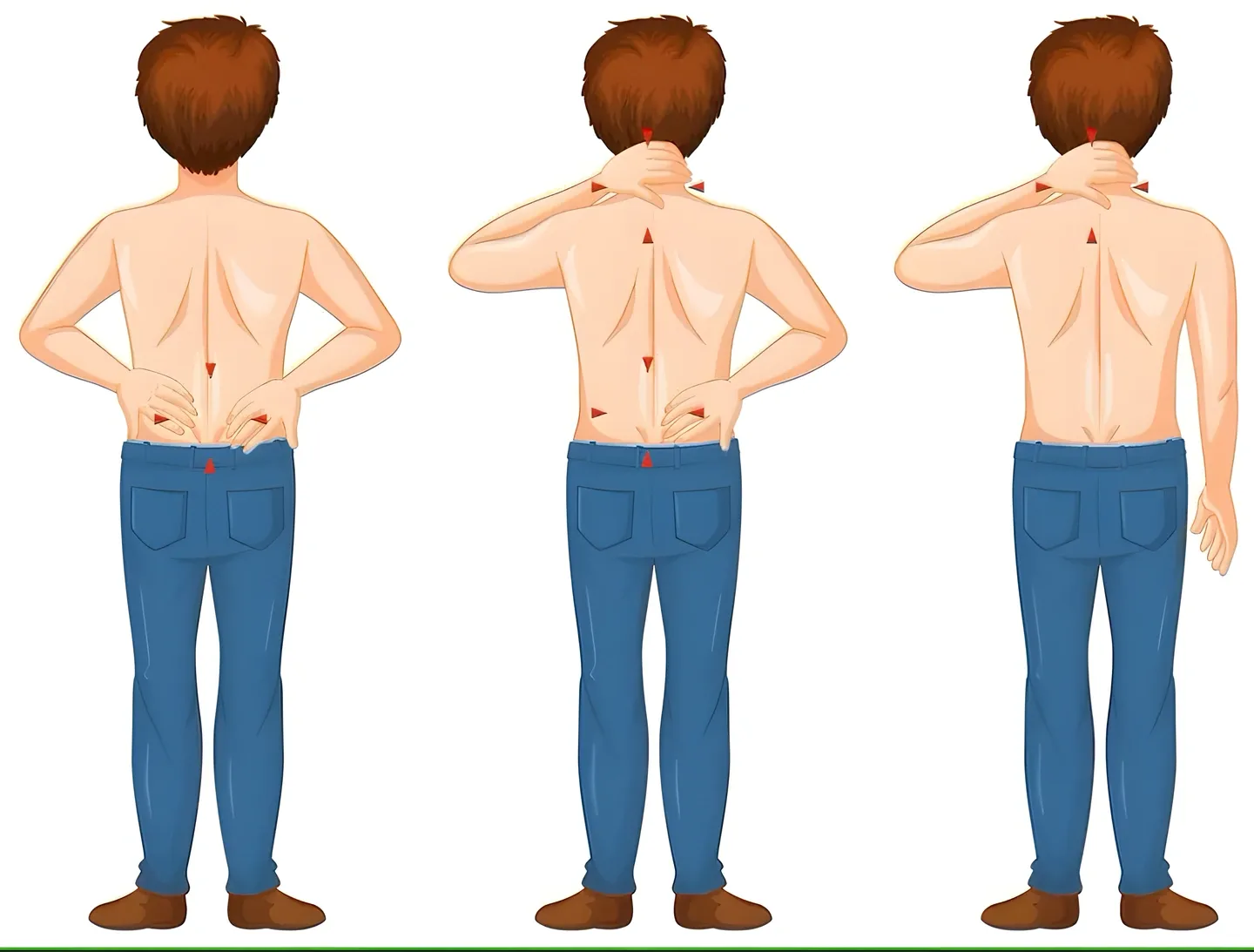 Các vị trí đau lưng thường gặp