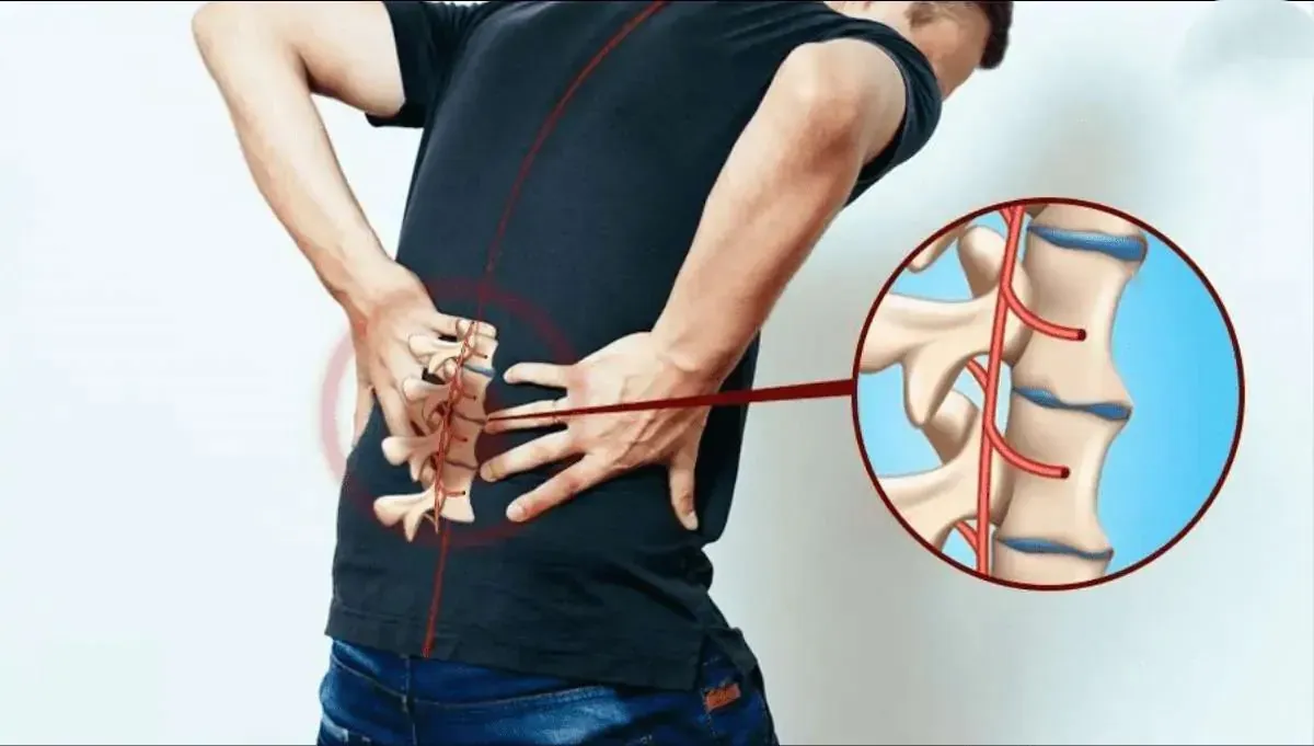 Đau lưng bên trái có thể do nguyên nhân từ cơ xương khớp