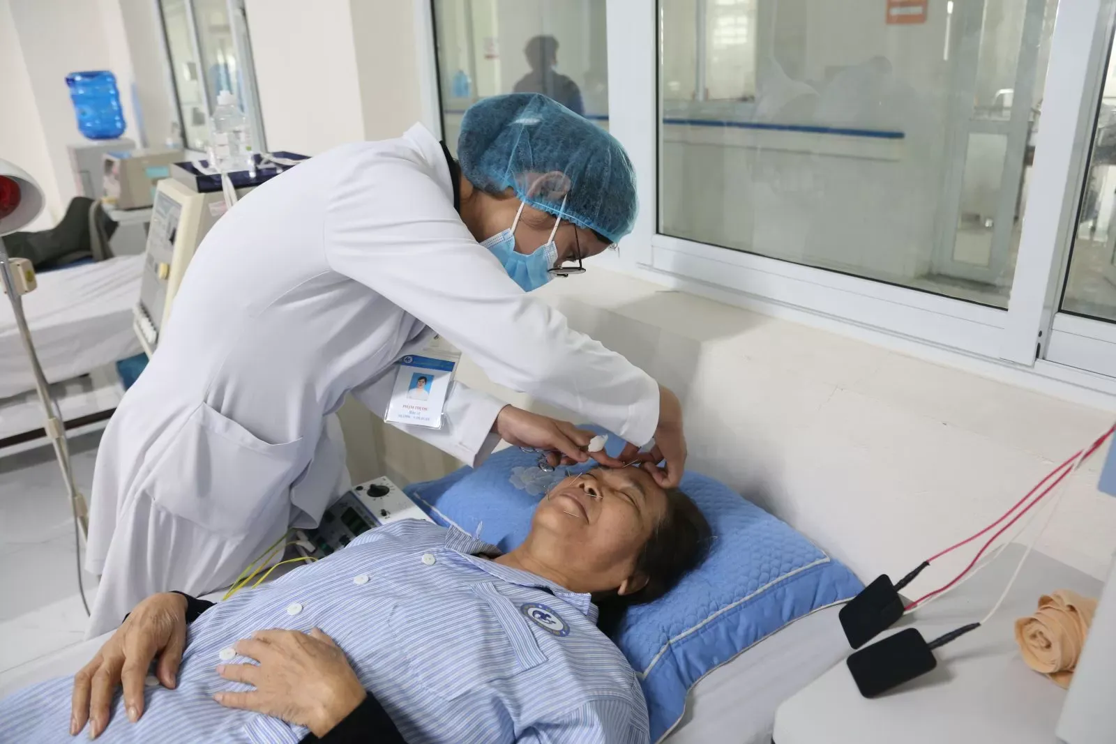 Châm cứu có thể được cân nhắc như một phương pháp hỗ trợ trong giai đoạn phục hồi liệt Bell