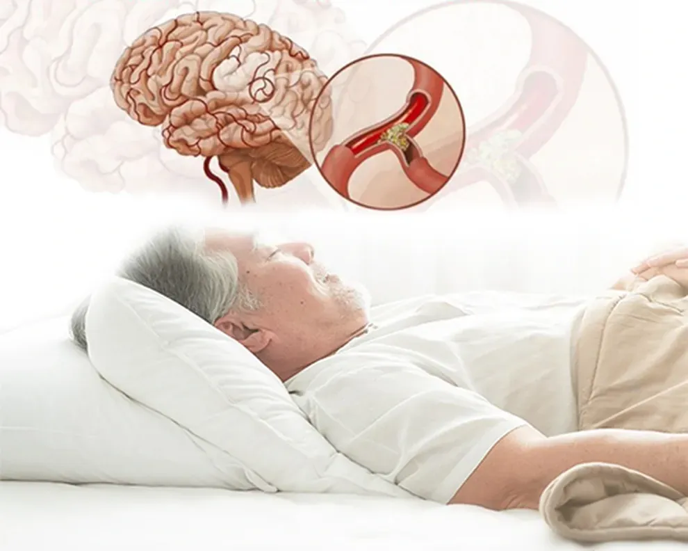 Người đàn ông lớn tuổi nằm ngủ, có nguy cơ ngưng thở khi ngủ