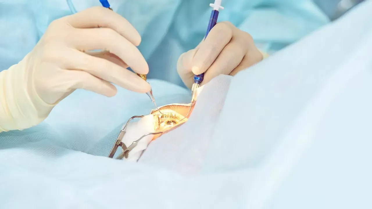 Điều trị sụp mí bằng phẫu thuật