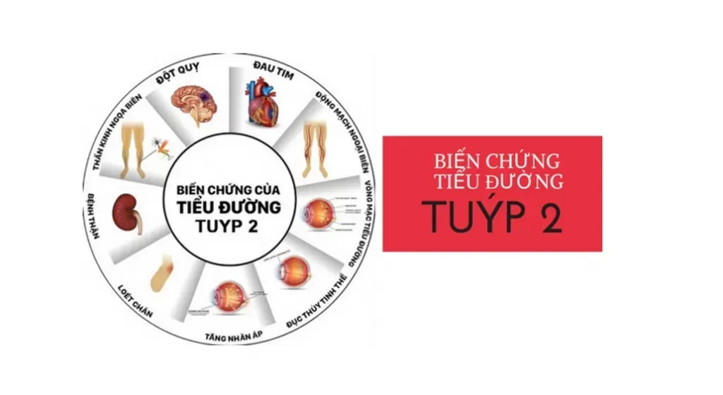 Tiểu đường tuýp 2 là một bệnh mạn tính nguy hiểm nếu không được kiểm soát tốt, bởi tình trạng tăng